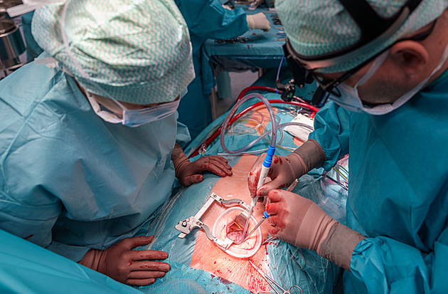 Světové Ústí. Pacientům se srdečním selháním pomáhá nejmodernější pumpa