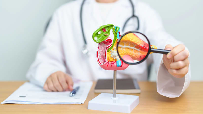 V Česku ročně zabije tisíce lidí: Rakovina tlustého střeva napadá i mladé. Jak snížit riziko?